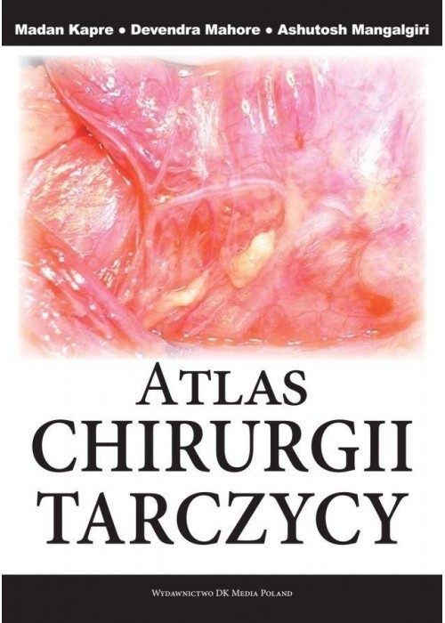 Atlas Chirurgii Tarczycy