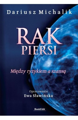 Rak piersi. Między ryzykiem a szansą