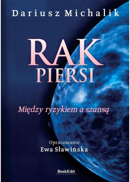 Rak piersi. Między ryzykiem a szansą