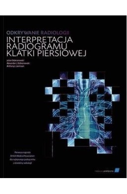 Odkrywanie radiologii: interpretacja radiogramu..