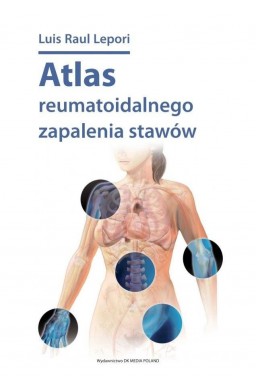 Atlas reumatoidalnego zapalenia stawów