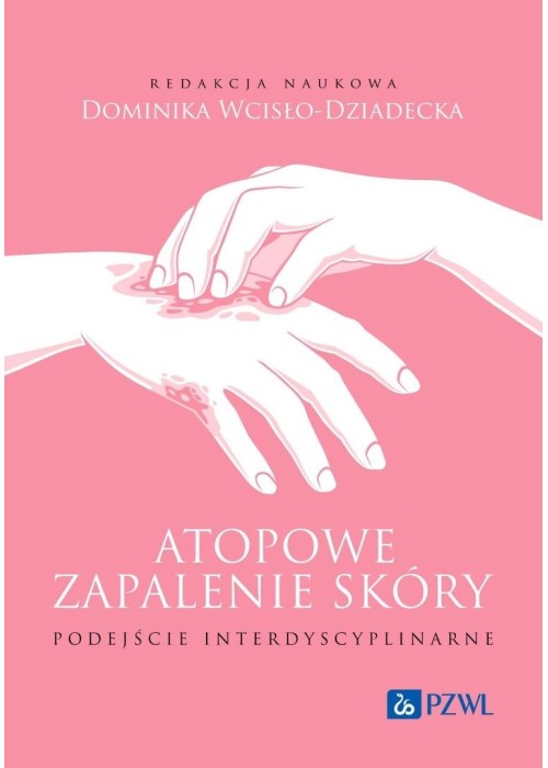 Atopowe zapalenie skóry. Podejście interdyscyplina