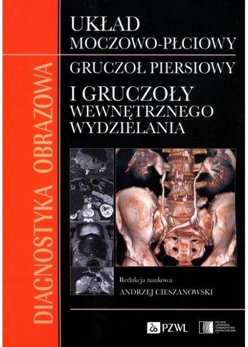 Diagnostyka obrazowa Układ moczowo-płciowy Gruczoł