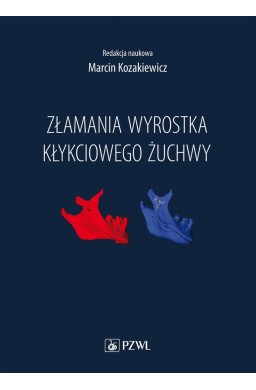 Złamania wyrostka kłykciowego żuchwy