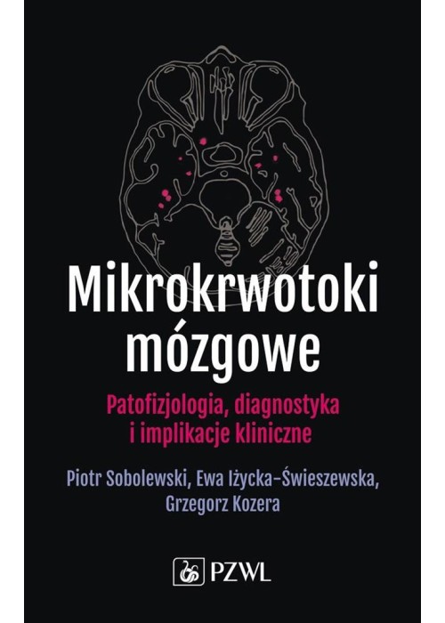 Mikrokrwotoki mózgoww
