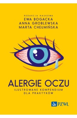 Alergie oczu. Ilustrowane kompendium dla praktyków