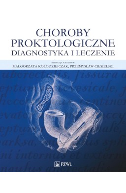 Choroby proktologiczne. Diagnostyka i leczenie