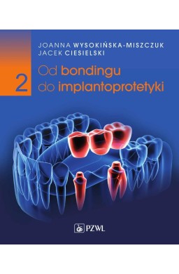 Od bondingu do implantoprotetyki cz.2