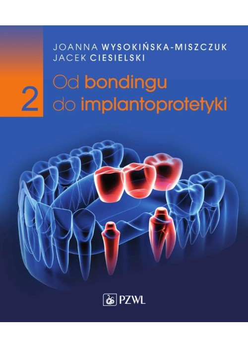Od bondingu do implantoprotetyki cz.2