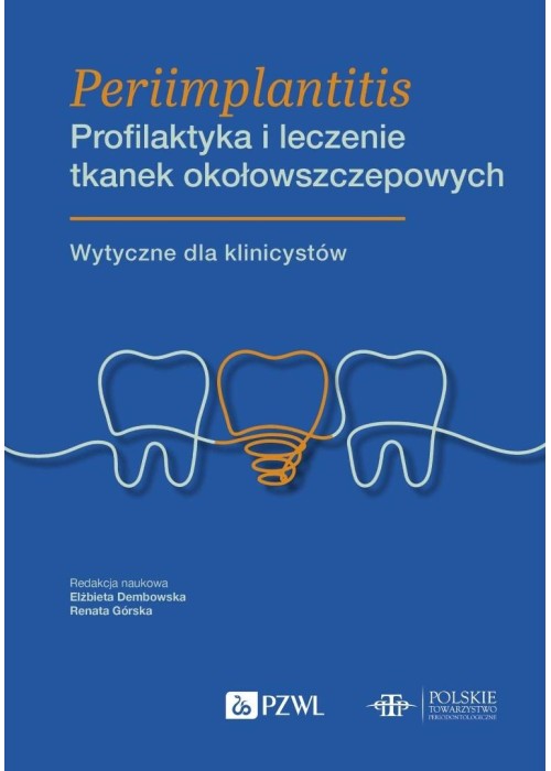 Periimplantitis. Profilaktyka i leczenie tkanek...