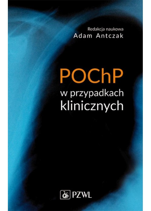 POCHP w przypadkach klinicznych