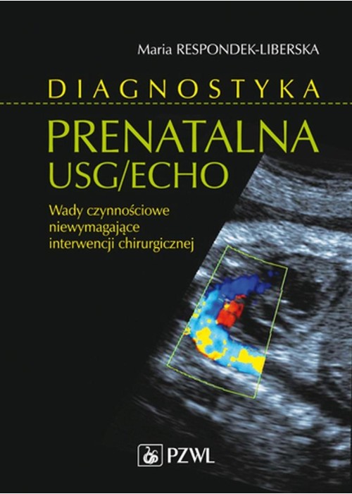 Diagnostyka prenatalna USG/ECHO. Wady niewymagając