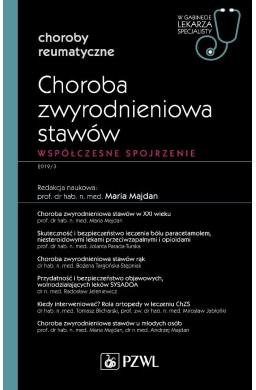 Choroba zwyrodnieniowa stawów. W gabinecie lekarza