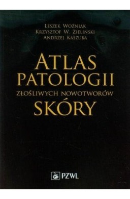 Atlas patologii złośliwych nowotworów skóry