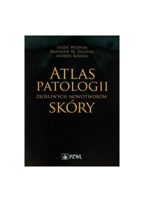 Atlas patologii złośliwych nowotworów skóry