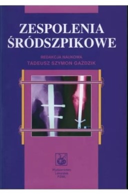 Zespolenia śródszpikowe