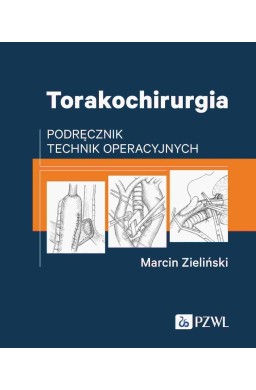 Torakochirurgia. Podręcznik technik operacyjnych