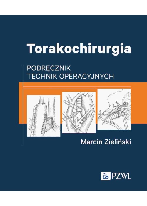 Torakochirurgia. Podręcznik technik operacyjnych