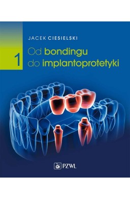 Od bondingu do implantoprotetyki cz. I