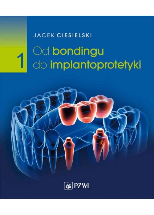 Od bondingu do implantoprotetyki cz. I