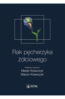 Rak pęcherzyka żółciowego