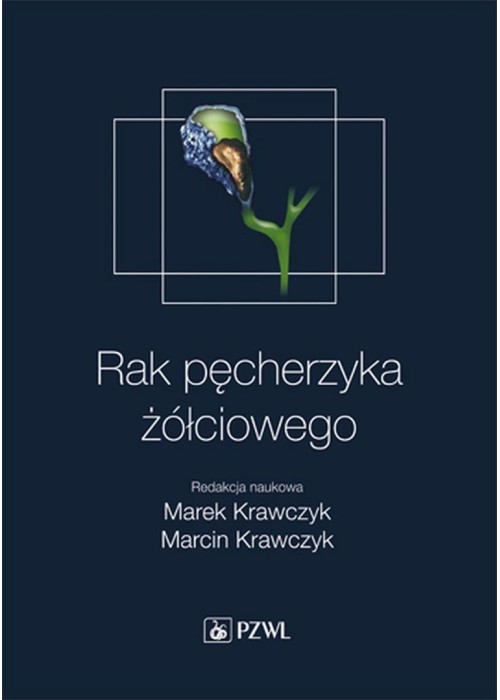 Rak pęcherzyka żółciowego