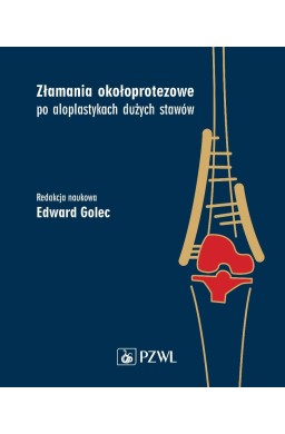 Złamania okołoprotezowe po aloplastykach dużych...