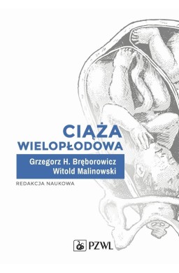 Ciąża wielopłodowa
