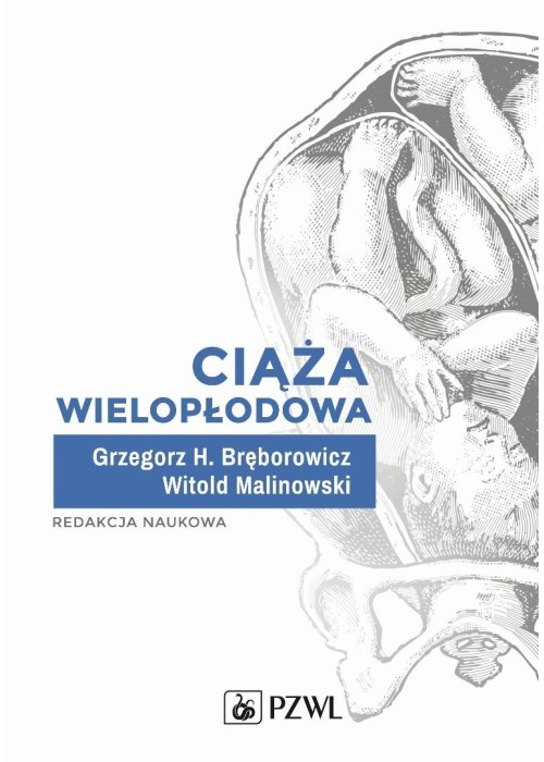 Ciąża wielopłodowa