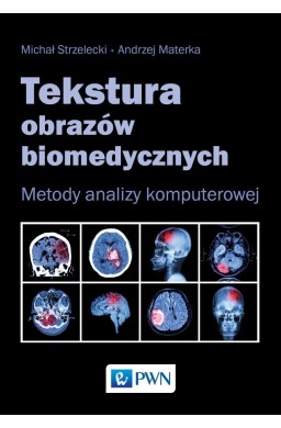 Tekstura obrazów biomedycznych. Metody analizym...