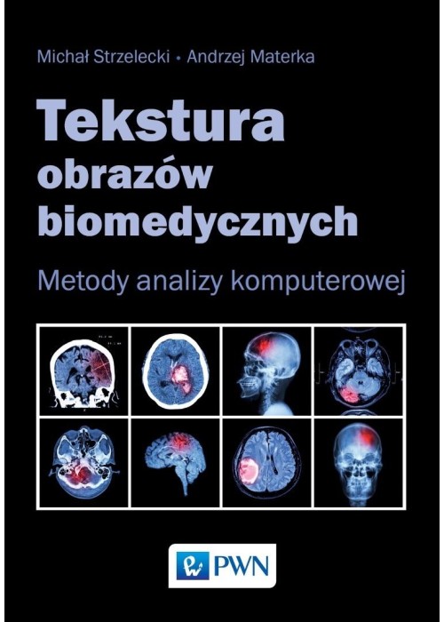 Tekstura obrazów biomedycznych. Metody analizym...