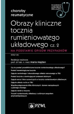 Obrazy kliniczne tocznia rumieniowatego układ cz.2