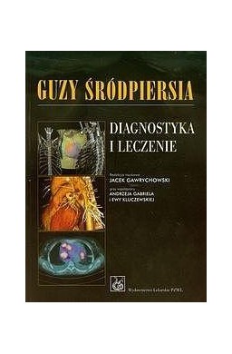 Guzy śródpiersia Diagnostyka i leczenie
