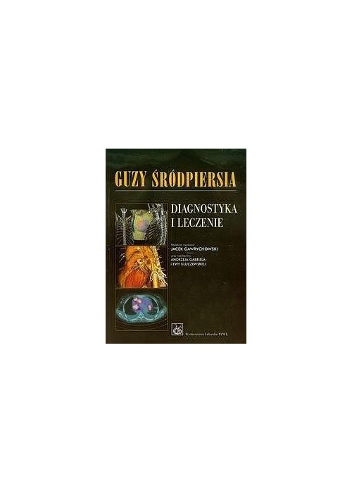 Guzy śródpiersia Diagnostyka i leczenie