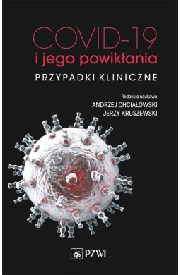 COVID-19 i jego powikłania - przypadki kliniczne