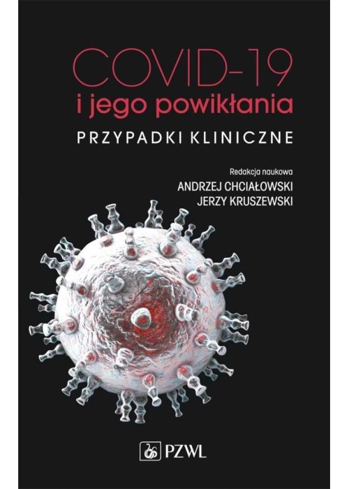 COVID-19 i jego powikłania - przypadki kliniczne