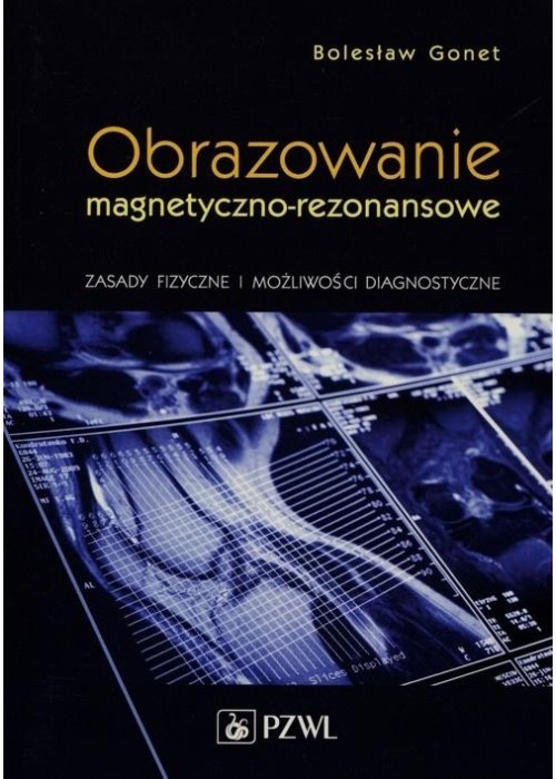 Obrazowanie magnetyczno-rezonansowe