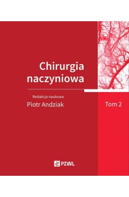 Chirurgia naczyniowa T. 2