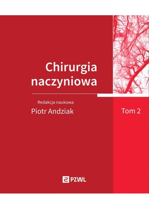 Chirurgia naczyniowa T. 2