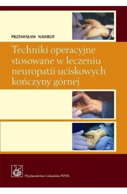 Techniki operacyjne stosowane w leczeniu..