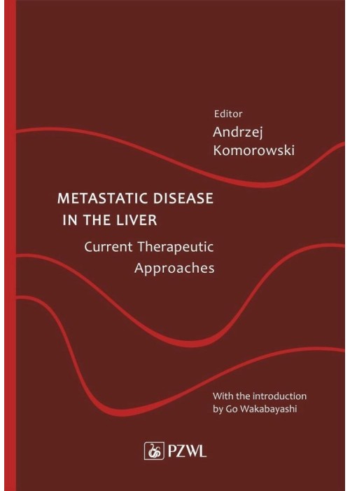 Metastatic Disease in the Liver