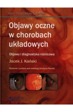 Objawy oczne w chorobach układowych