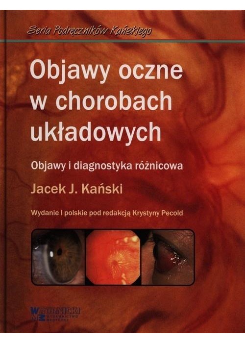 Objawy oczne w chorobach układowych