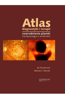 Atlas diagnostyki i terapii zwyrodnienia plamki...