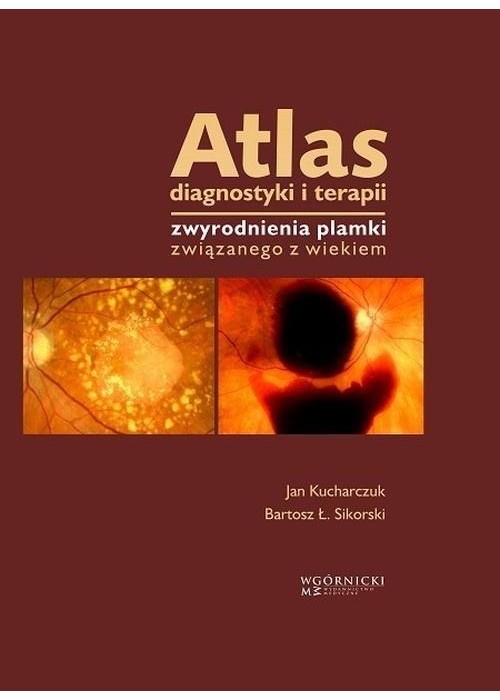 Atlas diagnostyki i terapii zwyrodnienia plamki...