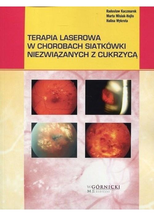 Terapia laserowa w chorobach siatkówki...