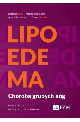 Lipoedema. Choroba grubych nóg