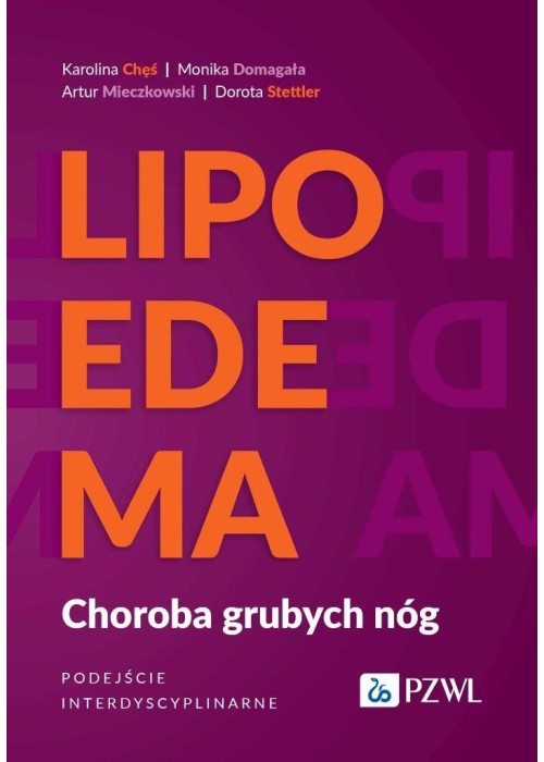 Lipoedema. Choroba grubych nóg