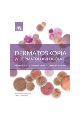 Dermatoskopia w dermatologii ogólnej