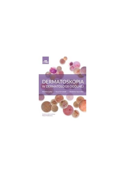 Dermatoskopia w dermatologii ogólnej